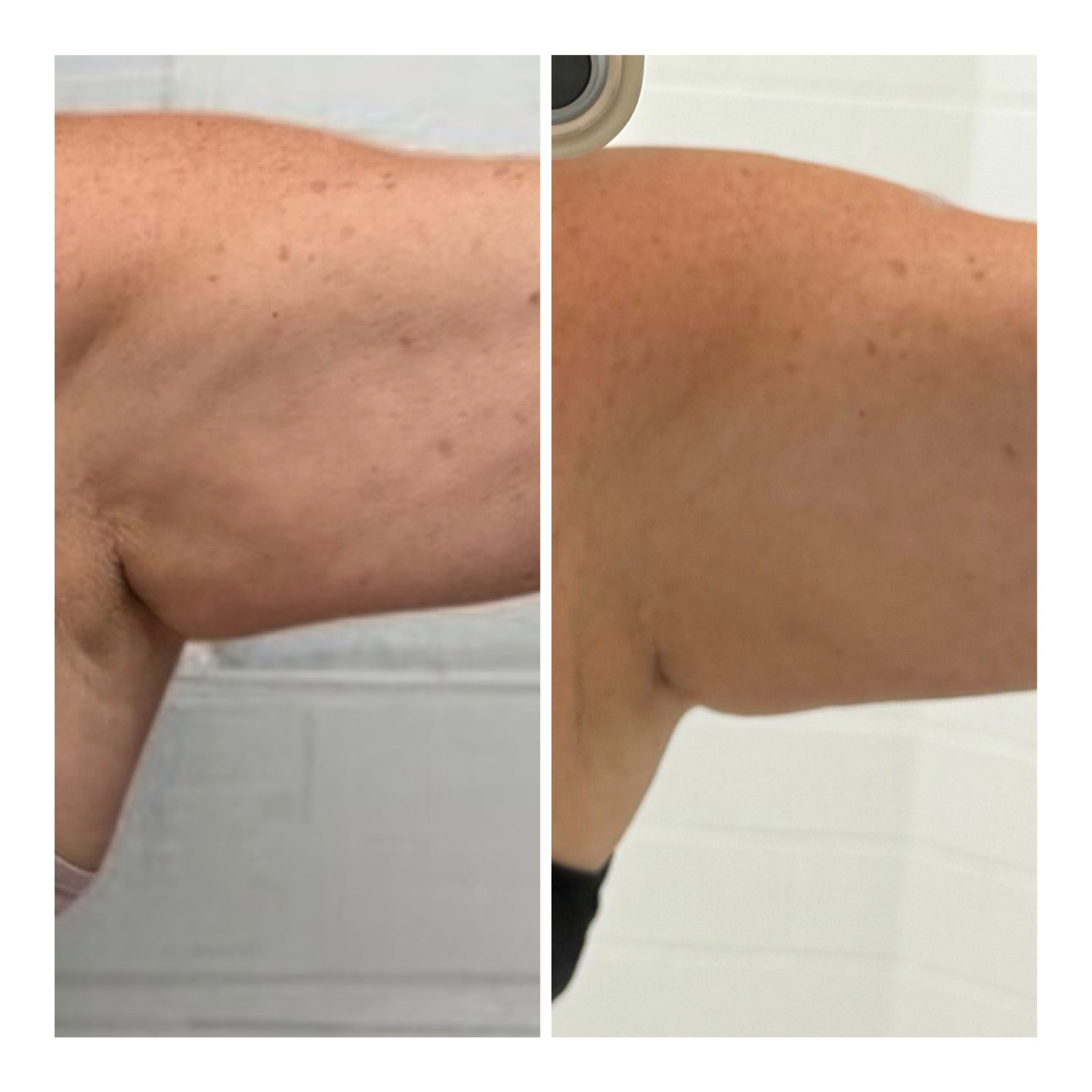 Detox Cellulite Gel